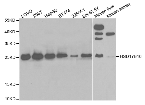 HSD17B10 / HADH2 Antibody - Western blot analysis of extracts of various cell lines.