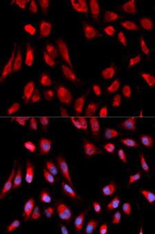 HSD17B10 / HADH2 Antibody - Immunofluorescence analysis of U20S cells.