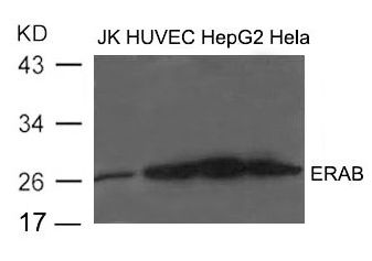 HSD17B10 / HADH2 Antibody - Western blot of extract from JK, HUVEC, HepG2 and HeLa cells using ERAB Antibody