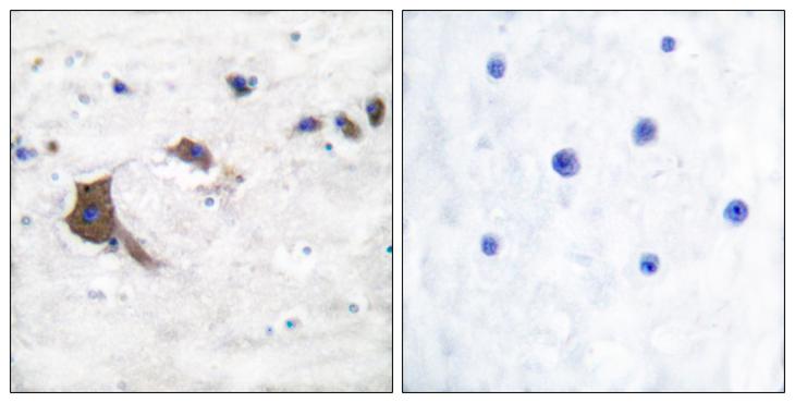 HSD17B10 / HADH2 Antibody - Peptide - + Immunohistochemical analysis of paraffin-embedded human brain tissue using ERAB antibody.