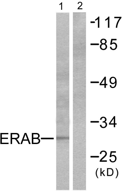 HSD17B10 / HADH2 Antibody - Western blot analysis of extracts from LOVO cells, using ERAB antibody.