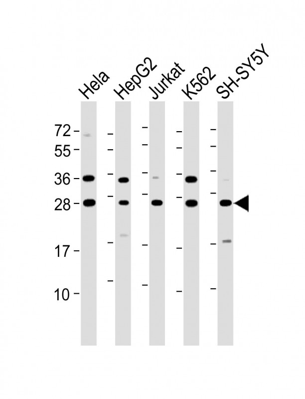 HSD17B10 / HADH2 Antibody - All lanes: Anti-HSD17B10 Antibody (N-Term) at 1:8000 dilution Lane 1: Hela whole cell lysate Lane 2: HepG2 whole cell lysate Lane 3: Jurkat whole cell lysate Lane 4: K562 whole cell lysate Lane 5: SH-SY5Y whole cell lysate Lysates/proteins at 20 µg per lane. Secondary Goat Anti-Rabbit IgG, (H+L), Peroxidase conjugated at 1/10000 dilution. Predicted band size: 27 kDa Blocking/Dilution buffer: 5% NFDM/TBST.