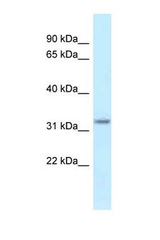 HSD17B11 Antibody - HSD17B11 antibody Western blot of Mouse Kidney lysate. Antibody concentration 1 ug/ml.  This image was taken for the unconjugated form of this product. Other forms have not been tested.