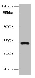 HSD17B11 Antibody - Western blot All lanes: HSD17B11 antibody at 10µg/ml + Mouse lung tissue Secondary Goat polyclonal to rabbit IgG at 1/10000 dilution Predicted band size: 33 kDa Observed band size: 33 kDa