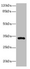HSD17B11 Antibody - Western blot All lanes: HSD17B11 antibody at 10µg/ml + Mouse lung tissue Secondary Goat polyclonal to rabbit IgG at 1/10000 dilution Predicted band size: 33 kDa Observed band size: 33 kDa