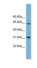 HSD17B11 Antibody - HSD17B11 antibody Western blot of COLO205 cell lysate. This image was taken for the unconjugated form of this product. Other forms have not been tested.