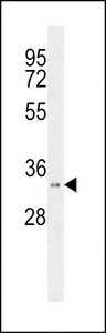 HSD17B11 Antibody - Western blot of HSD17B11 Antibody in WiDr cell line lysates (35 ug/lane). HSD17B11 (arrow) was detected using the purified antibody.