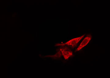 HSD17B11 Antibody - Staining 293 cells by IF/ICC. The samples were fixed with PFA and permeabilized in 0.1% Triton X-100, then blocked in 10% serum for 45 min at 25°C. The primary antibody was diluted at 1:200 and incubated with the sample for 1 hour at 37°C. An Alexa Fluor 594 conjugated goat anti-rabbit IgG (H+L) antibody, diluted at 1/600, was used as secondary antibody.