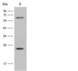 HSD17B11 Antibody - Anti-HSD17B11 rabbit polyclonal antibody at 1:500 dilution. Lane A: RAW264.7 Whole Cell Lysate. Lysates/proteins at 30 ug per lane. Secondary: Goat Anti-Rabbit IgG (H+L)/HRP at 1/10000 dilution. Developed using the ECL technique. Performed under reducing conditions. Predicted band size: 23 kDa. Observed band size: 23 kDa.