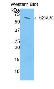 HSD17B12 Antibody - Western blot of recombinant HSD17B12.  This image was taken for the unconjugated form of this product. Other forms have not been tested.