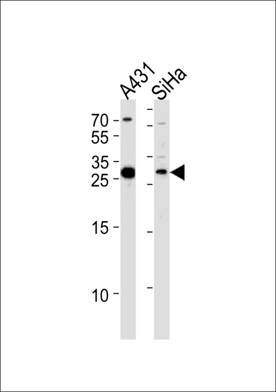 HSD17B12 Antibody - HSD17B12 Antibody western blot of A431,SiHa cell line lysates (35 ug/lane). The HSD17B12 antibody detected the HSD17B12 protein (arrow).