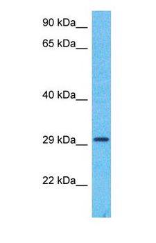 HSD17B12 Antibody - Western blot of DHB12 Antibody with human Fetal Liver lysate.  This image was taken for the unconjugated form of this product. Other forms have not been tested.