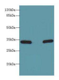 HSD17B12 Antibody - Western blot. All lanes: HSD17B12 antibody at 1.2 ug/ml. Lane 1: U251 whole cell lysate. Lane 2: A431 whole cell lysate. Secondary Goat polyclonal to Rabbit IgG at 1:10000 dilution. Predicted band size: 34 kDa. Observed band size: 34 kDa.