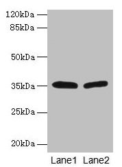 HSD17B12 Antibody - Western blot All lanes: HSD17B12 antibody at 1.2µg/ml Lane 1: U251 whole cell lysate Lane 2: A431 whole cell lysate Secondary Goat polyclonal to rabbit IgG at 1/10000 dilution Predicted band size: 35, 11 kDa Observed band size: 35 kDa