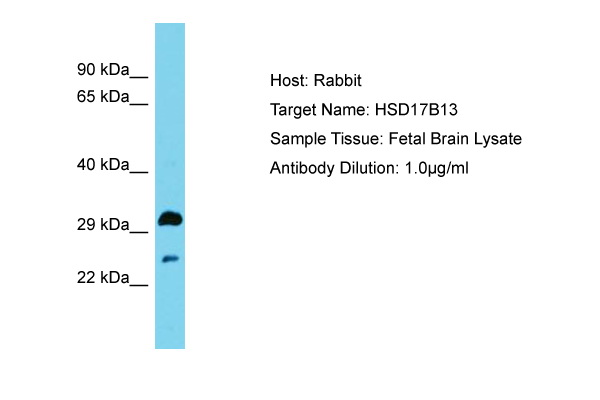 HSD17B13 Antibody -  This image was taken for the unconjugated form of this product. Other forms have not been tested.