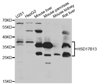 HSD17B13 Antibody - Western blot analysis of extracts of various cell lines.