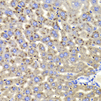 HSD17B13 Antibody - Immunohistochemistry of paraffin-embedded Mouse liver tissue.