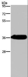 HSD17B13 Antibody - Western blot analysis of Human fetal liver tissue, using HSD17B13 Polyclonal Antibody at dilution of 1:350.
