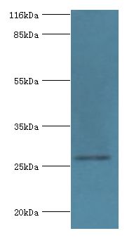 HSD17B14 Antibody - Western blot. All lanes: 17-beta-hydroxysteroid dehydrogenase 14 antibody at 2 ug/ml+mouse kidney tissue. Secondary antibody: Goat polyclonal to rabbit at 1:10000 dilution. Predicted band size: 28 kDa. Observed band size: 28 kDa.  This image was taken for the unconjugated form of this product. Other forms have not been tested.
