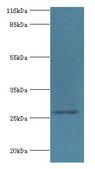 HSD17B14 Antibody - Western blot. All lanes: 17-beta-hydroxysteroid dehydrogenase 14 antibody at 2 ug/ml+mouse kidney tissue. Secondary antibody: Goat polyclonal to rabbit at 1:10000 dilution. Predicted band size: 28 kDa. Observed band size: 28 kDa.  This image was taken for the unconjugated form of this product. Other forms have not been tested.