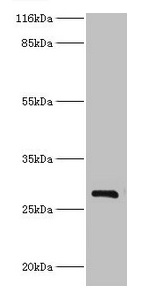 HSD17B14 Antibody - Western blot All lanes: HSD17B14 antibody at 2µg/ml + Mouse kidney tissue Secondary Goat polyclonal to rabbit IgG at 1/10000 dilution Predicted band size: 29 kDa Observed band size: 29 kDa