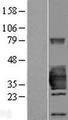 HSD17B14 Protein - Western validation with an anti-DDK antibody * L: Control HEK293 lysate R: Over-expression lysate