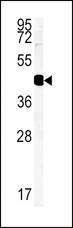 HSD17B2 Antibody - Western blot of HSD17B2 Antibody in MDA-MB435 cell line lysates (35 ug/lane). HSD17B2 (arrow) was detected using the purified antibody.