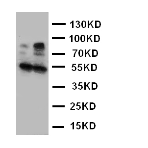 HSD17B2 Antibody - WB of HSD17B2 antibody. Lane 1: Human Placenta Tissue Lysate. Lane 2: Human Placenta Tissue Lysate.