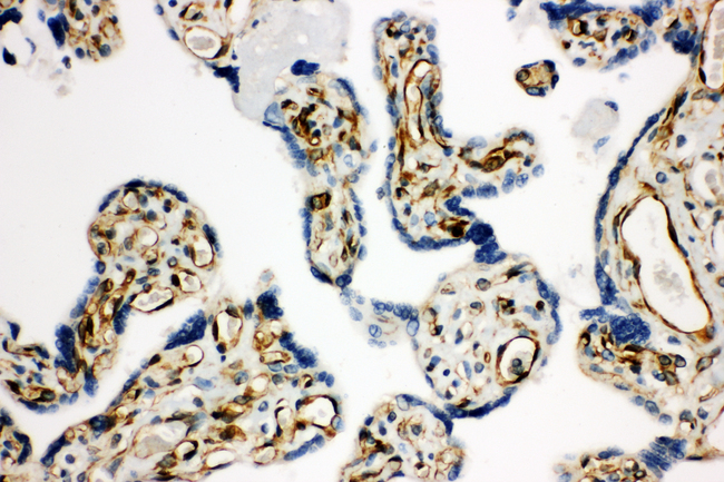 HSD17B2 Antibody - HSD17B2 antibody. IHC(P): Human Placenta Tissue.