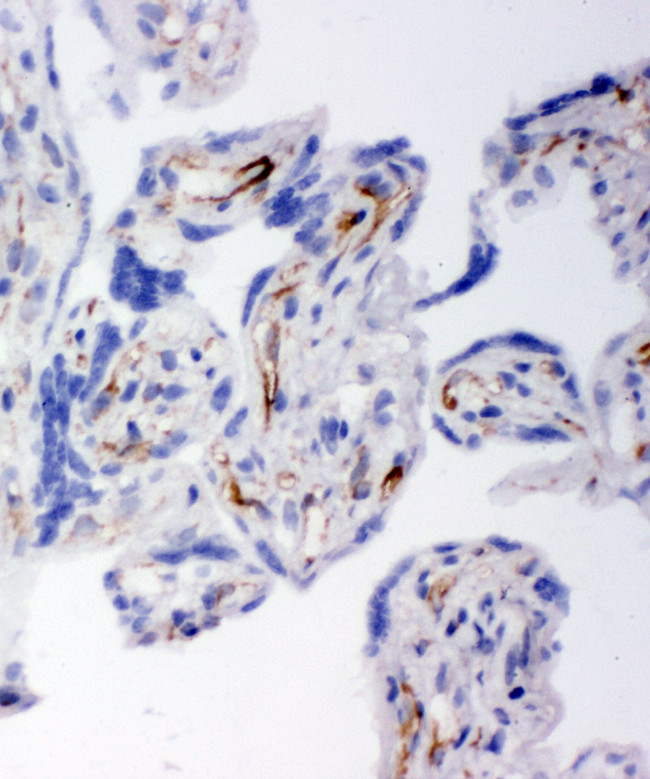 HSD17B2 Antibody - HSD17B2 antibody. IHC(F): Human Placenta Tissue.