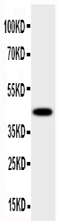 HSD17B2 Antibody - Anti-HSD17B2 antibody, Western blotting All lanes: Anti HSD17B2 at 0.5ug/mlWB: Human Placenta Tissue Lysate at 50ugPredicted bind size: 43KD Observed bind size: 43KD