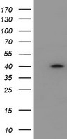 HSD17B2 Antibody - HEK293T cells were transfected with the pCMV6-ENTRY control (Left lane) or pCMV6-ENTRY HSD17B2 (Right lane) cDNA for 48 hrs and lysed. Equivalent amounts of cell lysates (5 ug per lane) were separated by SDS-PAGE and immunoblotted with anti-HSD17B2.