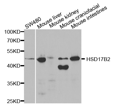 HSD17B2 Antibody - Western blot analysis of extracts of various cell lines.