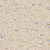 HSD17B2 Antibody - Immunohistochemistry of paraffin-embedded rat brain tissue.