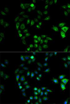 HSD17B2 Antibody - Immunofluorescence analysis of U2OS cells.