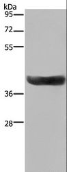 HSD17B2 Antibody - Western blot analysis of Human fetal liver tissue, using HSD17B2 Polyclonal Antibody at dilution of 1:300.
