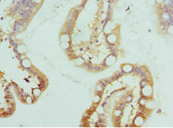 HSD17B2 Antibody - Immunohistochemistry of paraffin-embedded human small intestine at dilution 1:100