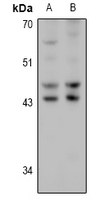 HSD17B2 Antibody - Western blot analysis of HSD17B2 expression in HCT116 (A), CT26 (B) whole cell lysates.