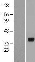 HSD17B2 Protein - Western validation with an anti-DDK antibody * L: Control HEK293 lysate R: Over-expression lysate