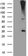HSD17B3 Antibody - HEK293T cells were transfected with the pCMV6-ENTRY control. (Left lane) or pCMV6-ENTRY HSD17B3. (Right lane) cDNA for 48 hrs and lysed. Equivalent amounts of cell lysates. (5 ug per lane) were separated by SDS-PAGE and immunoblotted with anti-HSD17B3. (1:2000)