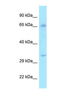 HSD17B3 Antibody - HSD17B3 antibody Western blot of 721_B Cell lysate. Antibody concentration 1 ug/ml.  This image was taken for the unconjugated form of this product. Other forms have not been tested.