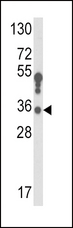HSD17B3 Antibody - Western blot of HSD17B3 Antibody in K562 cell line lysates (35 ug/lane). HSD17B3 (arrow) was detected using the purified antibody.