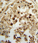 HSD17B3 Antibody - Formalin-fixed and paraffin-embedded human testis tissue reacted with HSD17B3 Antibody , which was peroxidase-conjugated to the secondary antibody, followed by DAB staining. This data demonstrates the use of this antibody for immunohistochemistry; clinical relevance has not been evaluated.