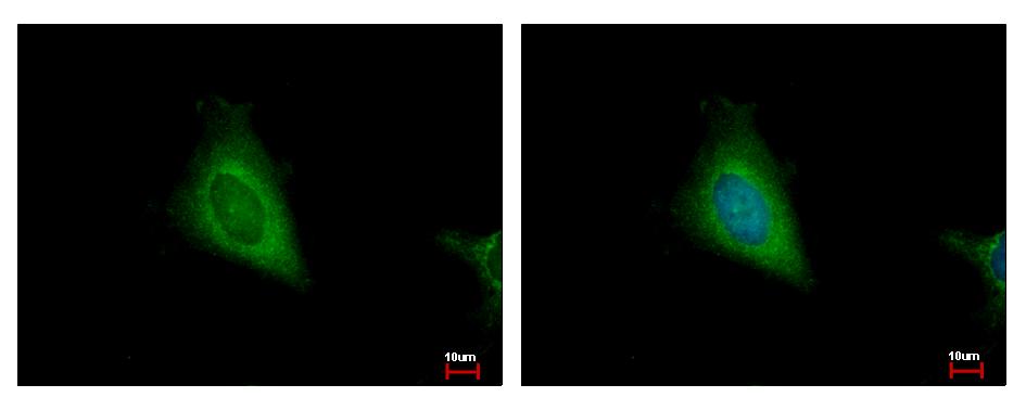 HSD17B4 Antibody - HSD17B4 antibody detects HSD17B4 protein at cytoplasm by immunofluorescent analysis. HeLa cells were fixed in 2% paraformaldehyde/culture medium at 37 for 30 min. HSD17B4 protein stained by HSD17B4 antibody diluted at 1:500.