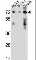 HSD17B4 Antibody - HSD17B4 Antibody western blot of MCF-7,ZR-75-1,HepG2 cell line lysates (35 ug/lane). The HSD17B4 antibody detected the HSD17B4 protein (arrow).