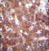 HSD17B4 Antibody - HSD17B4 Antibody immunohistochemistry of formalin-fixed and paraffin-embedded human liver tissue followed by peroxidase-conjugated secondary antibody and DAB staining.