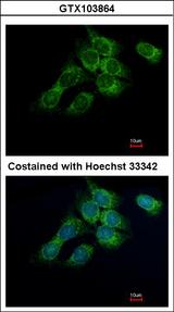 HSD17B4 Antibody - Immunofluorescence of methanol-fixed Hep3B using HSD17B4 antibody at 1:500 dilution.