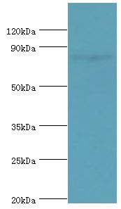 HSD17B4 Antibody - Western blot. All lanes: Peroxisomal multifunctional enzyme type 2 antibody at 3 ug/ml+mouse liver tissue. Secondary antibody: Goat polyclonal to rabbit at 1:10000 dilution. Predicted band size: 80 kDa. Observed band size: 80 kDa Immunohistochemistry.