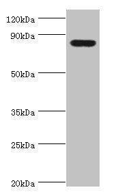 HSD17B4 Antibody - Western blot All lanes: Peroxisomal multifunctional enzyme type 2 antibody at 3µg/ml + Mouse liver tissue Secondary Goat polyclonal to rabbit IgG at 1/10000 dilution Predicted band size: 80, 84, 78 kDa Observed band size: 80 kDa