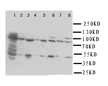 HSD17B4 Antibody - WB of HSD17B4 antibody. Lane 1: Rat Liver Tissue Lysate . Lane 2: Rat Brain Tissue Lysate. Lane 3: Rat Testis Tissue Lysate. Lane 4: Rat Small Intestine Tissue Lysate . Lane 5: SMMC Cell Lysate . Lane 6: HELA Cell Lysate. Lane 7: U87 Cell Lysate . Lane 8: COLO320 Cell Lysate.